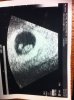 baby3bean.jpg