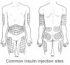 injection sites.jpg