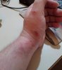 wrist.jpg