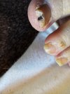 black toe nail.jpg
