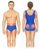 Insulin-injection-sites-2.jpg