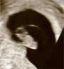 8 weeks.jpg