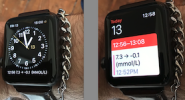 Sugarmate on Apple Watch.png