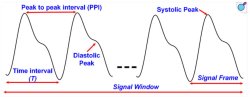PPG_Waveform_Features_05-26-2025_02.jpg