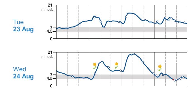 Overnight Basal Test